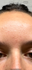 En